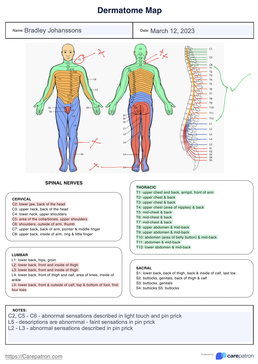 Dermatomes Anatomical Chart